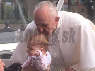 Pápež pobozkal bábätko s nádorom na mozgu: Lekári neveria vlastným očiam, je to zázrak?