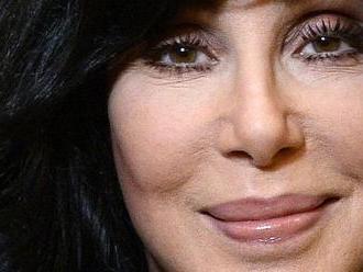 Cher oslavila sedmdesáté narozeniny. Jak vypadala bez plastik a jak vypadá nyní? Prohlédněte si naši