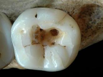 K zubaři se dalo zajít už před 14 000 lety