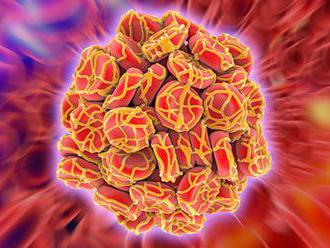 Časté a vážné onemocnění aneb Co byste měli vědět o žilní trombóze a embolii
