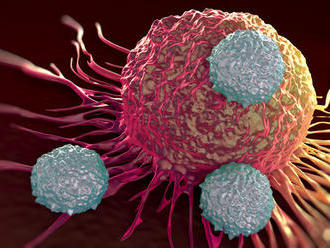 Spiace imunitné bunky možno prebudiť na boj s rakovinou