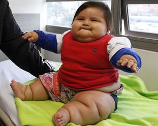 Po celom svete žije rekordných 124 miliónov obéznych detí