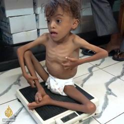 Za nezájmu světové veřejnosti zemře v Jemenu do konce roku 50 000 dětí. To je 130 dětí denně
