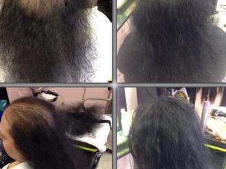 Štúdio INFINITY klientom po zdravotných komplikáciách, či trpiacim nadmernou stratou vlasov venuje k