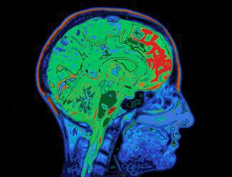Mozek agresivních řidičů pracuje jinak, ukázal výzkum