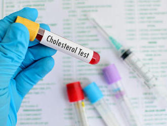 Vyhodnotenie veľkého cholesterolového testu: Vedeli ste všetko?