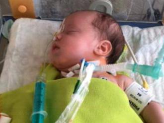 9 hodin na sále: Lékaři z Motola odstraňovali nádor tříměsíčnímu chlapečkovi