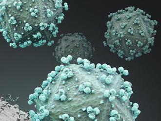 Slovenskí vedci hľadajú nanočastice proti HIV