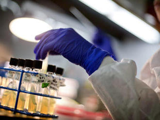 Ozbrojené sily kupujú nové špeciálne mikrobiologické laboratórium