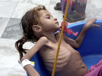 OSN varuje pred vypuknutím veľkého hladomoru v Jemene