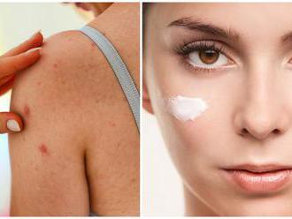 FOTO kozmetiky, ktorá vám spôsobí kožné problémy: Nebezpečné krémy a farby sa predávajú v celej EÚ