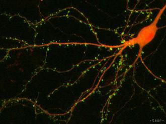 Vedci SAV skúmajú biomateriály pre obnovu mozgových buniek