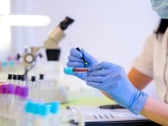 Vedci z Austrálie vyvinuli krvný test na detekciu melanómu, odhalí ranné štádium rakoviny kože