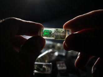 Místo endoskopie přijde čip plný svítících bakterií propojený s Androidem