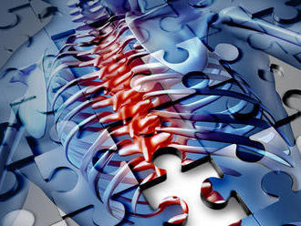 Osteoporóza: Porazte ju aj pohybom + cviky
