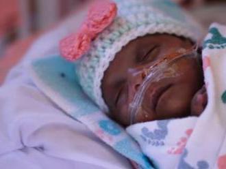 Dievčatko po narodení vážilo 245 gramov: Nemalo prežiť viac ako hodinu, stal sa zázrak