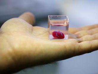 Vedcom sa podaril prelomový objav, vytlačili 3D srdce z tkaniva a ciev