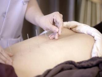 Žena   zašla prvýkrát na akupunktúru, takmer ju to zabilo