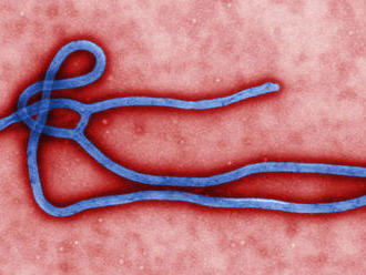 Vedci majú dva lieky proti ebole