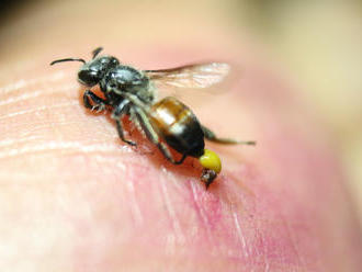 Aj včelie bodnutie môže liečiť