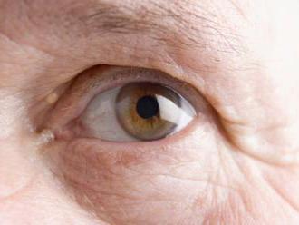Pacientovi s cukrovkou v Žiline zachránili zrak vďaka špecializovanej operácii