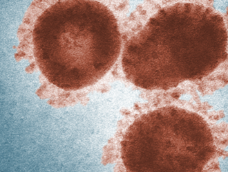 Vedci vyvinuli prvý test na nový koronavírus z Číny