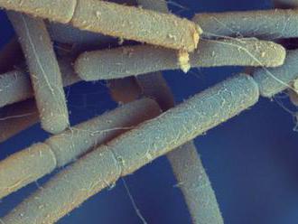 Slovenskí a českí vedci popísali jav, ku ktorému dochádza pri smrti bakteriálnej bunky