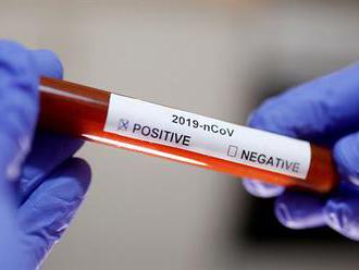 Koronavirus si v Číně vyžádal už 2442 obětí. V Itálii kvůli nákaze zrušili fotbalové zápasy