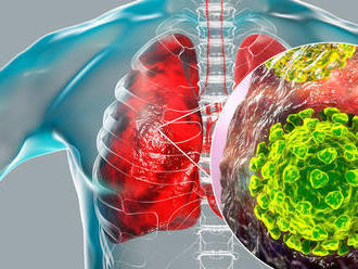 Zábery, ktoré mrazia: 'Prelet' pľúcami zdevastovanými koronavírusom