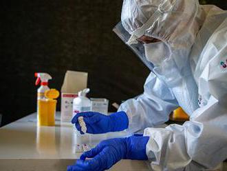 V sobotu přibylo v Česku 34 nakažených koronavirem. Klesl počet těžce nemocných
