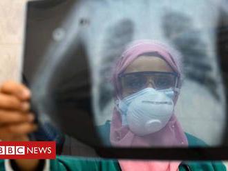 Coronavirus: Egypt doctors accuse government over medics' deaths