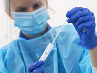 Britskí vedci plánujú otestovať vakcínu proti koronavírusu na viac ako 10-tisíc ľuďoch