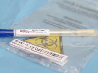 Coronavirus testing: How long does it take to get test results for COVID-19?     - CNET