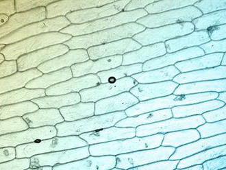 Vedci prvýkrát zobrazili mikroskopom kapsule so živými bunkami