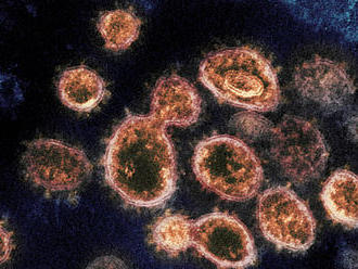 Vedci sa pokúšajú lepšie pochopiť systém imunitnej odpovede na koronavírus