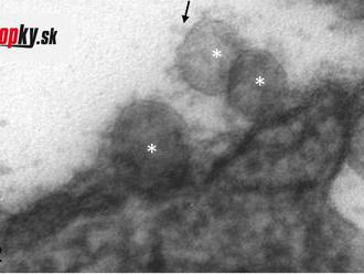 FOTO: Takto vyzerá „slovenský“ koronavírus. Vedci zo SAV ukázali vírusové častice