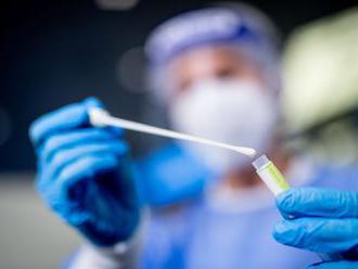 Pandemická komisia súhlasí, aby sa očkovaní nemuseli testovať