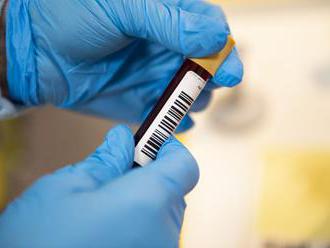 Na východe preveria imunitu, testy na protilátky budú zadarmo