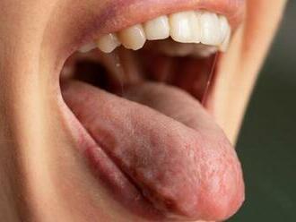 Náhodný objav môže viesť k novej liečbe sucha v ústach