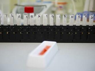 Jarčuška po testoch na protilátky: Sme na dobrej ceste ku kolektívnej imunite