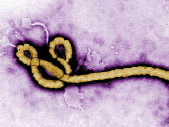 Epidémia eboly v Guinei sa skončila, vyžiadala si 12 obetí