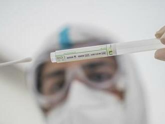 Košičania, zbystrite pozornosť: Univerzitná nemocnica presúva PCR testovanie, tu budú robiť odbery