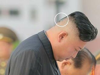 Lidé v Severní Koreji řeší Kimovu skvrnu na temeni. Diktátor ji později přelepil