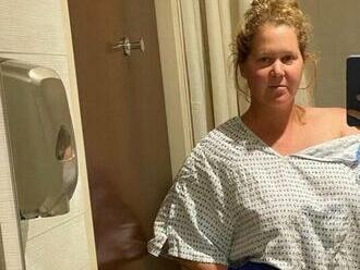 Endometrióza pripravila Amy Schumer o maternicu a slepé črevo  