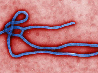 Ebola je porazená, tvrdí virológ, ktorý tento vírus spoluobjavil