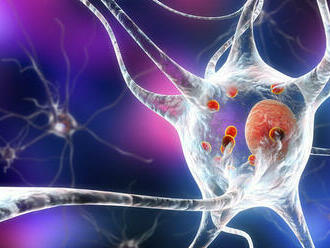 Vedci vytvorili v laboratóriu malé ľudské mozgy s Parkinsonovou chorobou