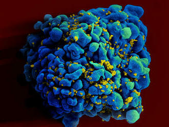 Nové mRNA očkování proti viru HIV vyvolává mírný optimismus