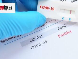 KORONAVÍRUS Najviac pozitívnych výsledkov PCR testov bolo vo veku od 35 do 44 rokov