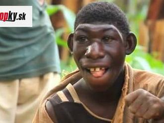 VIDEO Chlapec žil medzi opicami, prezývali ho Mauglí: Radikálna zmena! Keď uvidíte, ako vyzerá teraz