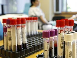 29. ročník Študentskej kvapky krvi dopadol nad očakávania: Krv prišlo darovať niekoľko tisíc ľudí!